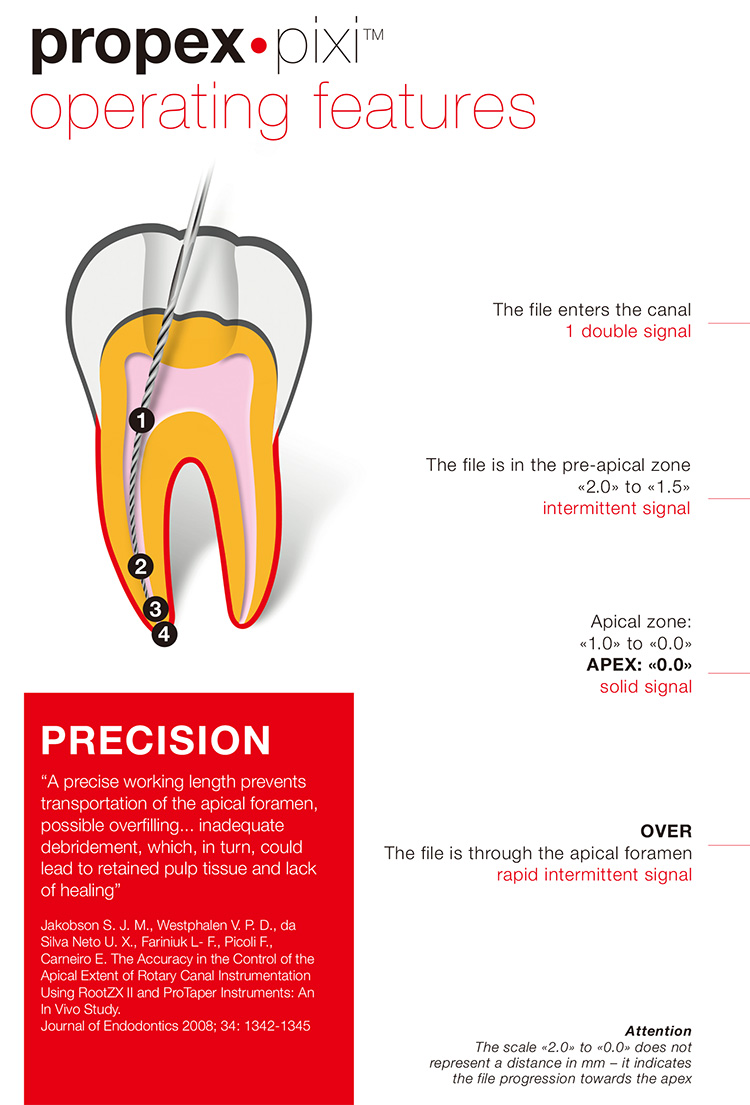 Dentsply propex pixi